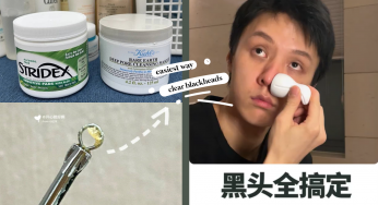 和草莓鼻说拔掰！骆王宇「去黑头法」万试万灵：准备Kiehl’s白泥面膜、水杨酸棉片，产品易买方法简单！